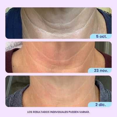 Crema Reafirmante y Tensora para Cuello y Escote