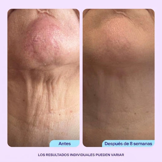 Crema Reafirmante y Tensora para Cuello y Escote