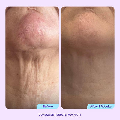 Tighten & Lift Neck Cream